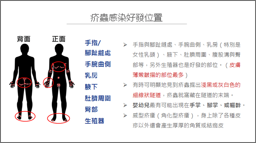 【醫療保健】疥瘡治療藥物大補帖 - Elaine藥師有話要說!